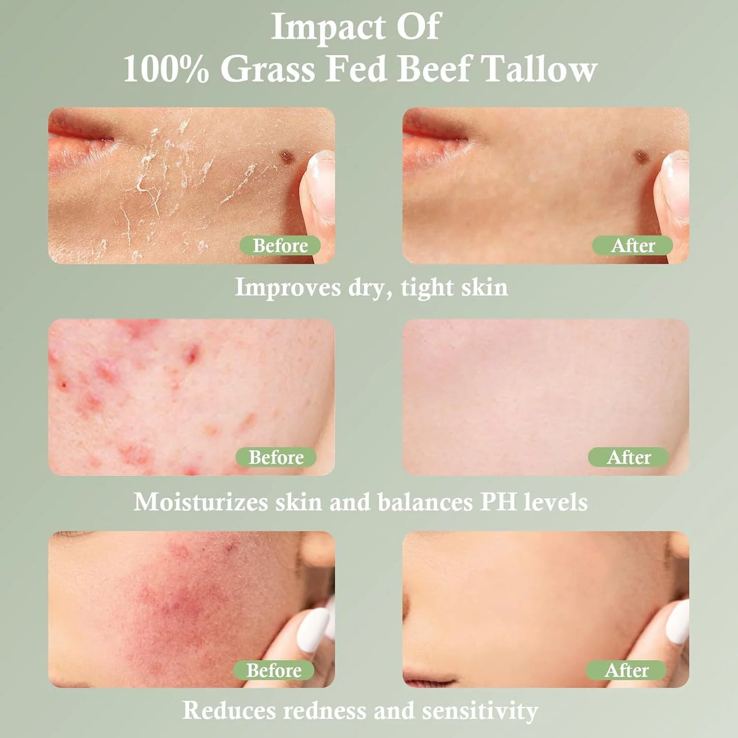 Grass-Fed Tallow Moisturizing Cream – Deeply Soothing & Nourishing